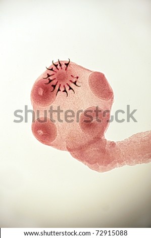 Pork Tapeworm Pictures