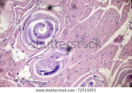 Trichinella spiralis - parasitic worm in muscle