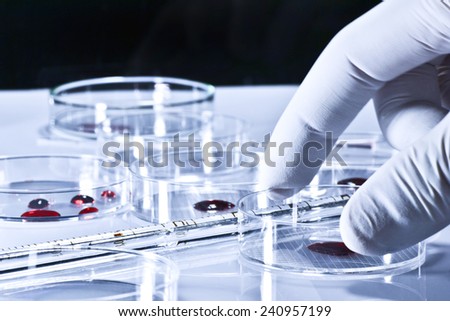 Laboratory work performed on petri dishes in plant microbiology.