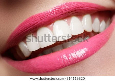 Perfect smile after bleaching. Dental care and whitening teeth. Woman smile with great teeth. Close-up of smile with white healthy teeth
