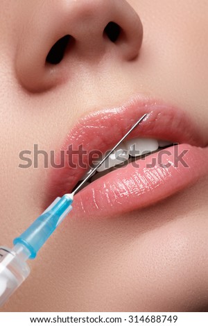 Closeup of beautiful woman gets injection in her lips. Full\
lips. Beautiful face and the syringe (plastic surgery and cosmetic injection\
concept).