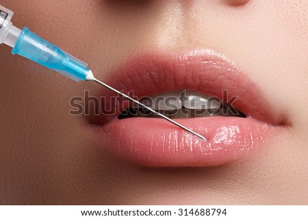 Closeup of beautiful woman gets injection in her lips. Full
lips. Beautiful face and the syringe (plastic surgery and cosmetic injection
concept).