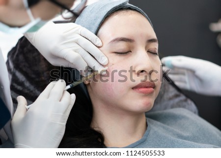 Botox, Filler injection for Asian female face. Plastic aesthetic facial surgery in beauty clinic.