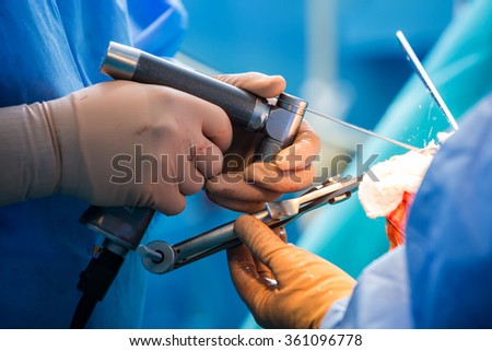 Orthopedic surgeon performing osteotomy in az arthritic knee.