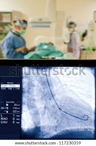Medical team performing medical procedure, focus on x-ray screen