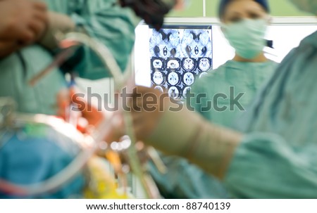 Blurred figures of people in medical uniforms performing brain surgery, focus on xray