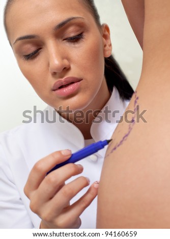 Doctor drawing correction lines on female waist