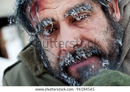 Close-up of homeless male face covered with frost