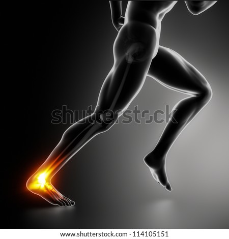Injured Heel