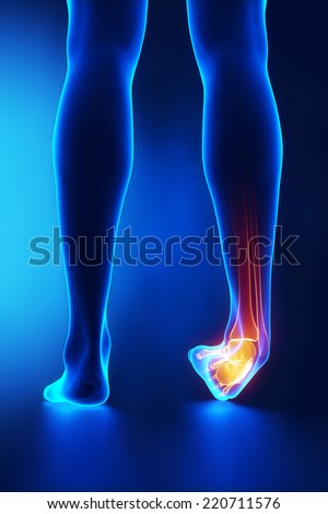 Sprained ankle blue x-ray
