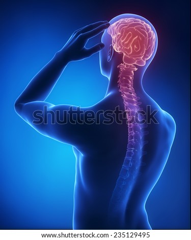 Headache on blue x-ray
