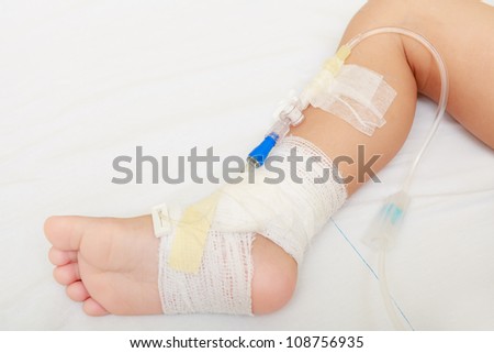 Leg of injured baby with bandage and medical equipments