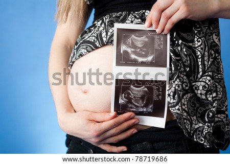 Pregnant woman\'s belly with ultrasound photo