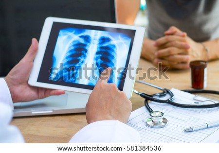 Doctor shows results to old patient x-ray of the lungs, smoking cigarettes problem