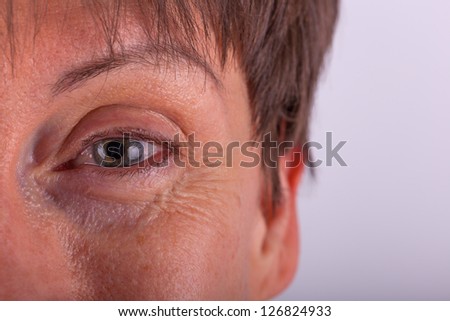 Close-up view of an elderly persons eye