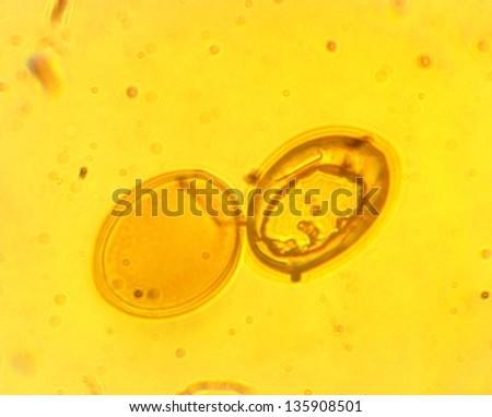 Lancet liver fluke eggs (Dicrocoelium dendriticum) - permanent slide plate under high magnification