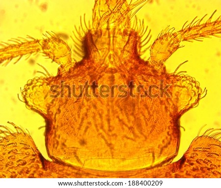 Common bed bug (Cimex lectularius) head - permanent slide plate under high magnification