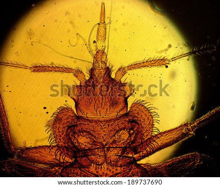 Common bed bug (Cimex lectularius) underside - permanent slide plate under high magnification