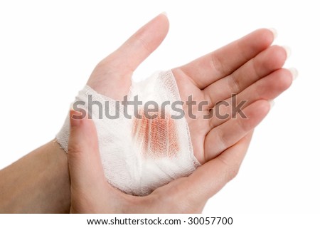 stock photo The injured hand of the girl tied up by white bandage