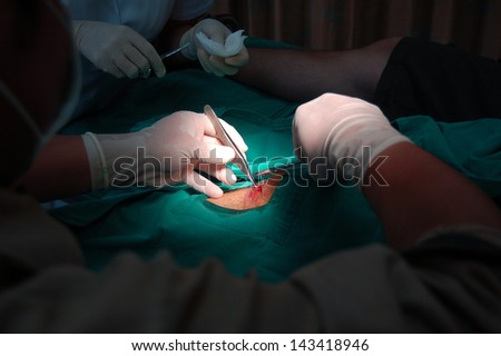Detailed close-up of doctors hands performing surgery