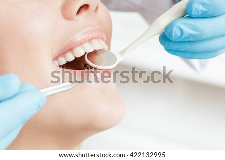 Healthy teeth. Cropped closeup of a female client smiling cheerfully with her healthy teeth during dental examination at her dentist