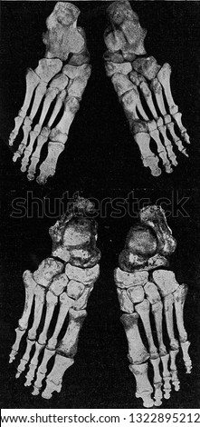 Skeleton of the right foot and the left foot of the man, vintage photo. From the Universe and Humanity, 1910.