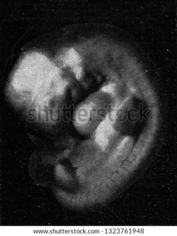 Human embryo, vintage photo. From the Universe and Humanity, 1910.