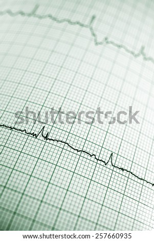 Close up of an electrocardiogram in paper form.