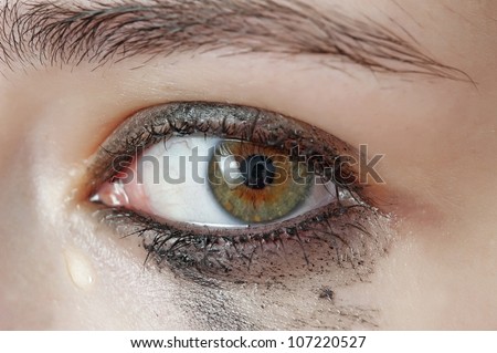watery eye - sensitive eye of young girl - crying eye