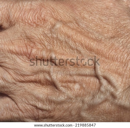 wrinkled woman skin on hand