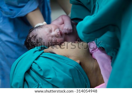 First sight of mom and her newborn in operation room