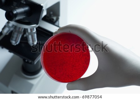 Scientist with blood cell culture dish and microscope in laboratory selective focus