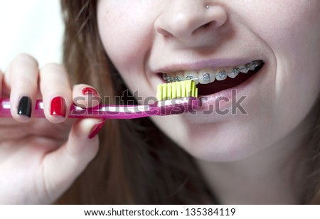 Orthodontic brush usage for cleaning of bracket system
