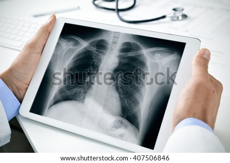 closeup of a young caucasian doctor man sitting at his office desk observing a chest radiograph in a tablet computer