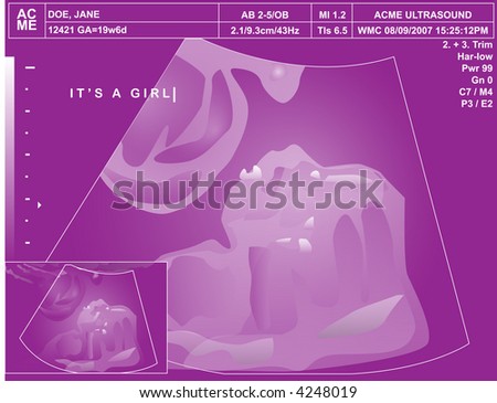 It\'s a girl! Rendered illustration of pink-tinged ultrasound with the words \