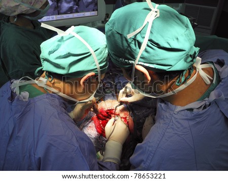 Hospital Operation, Brain Surgery