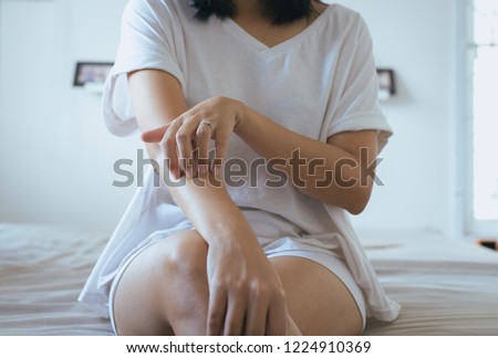Female with rash or papule and scratchon her arm from allergies,Health allergy skin care problem