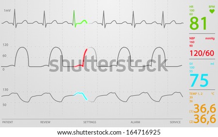 Image of schematic Intensive Care Unit monitor showing normal values for vital signs, starting with cardiac frequency. White background.