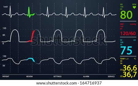 Image of schematic Intensive Care Unit monitor showing normal values for vital signs, starting with cardiac frequency. Dark background.