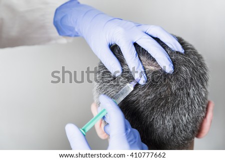 Doctor aesthetician with blue medical gloves makes hyaluronic acid rejuvenation beauty injections in the back of the head of male patient for hair growth and to prevent boldness.