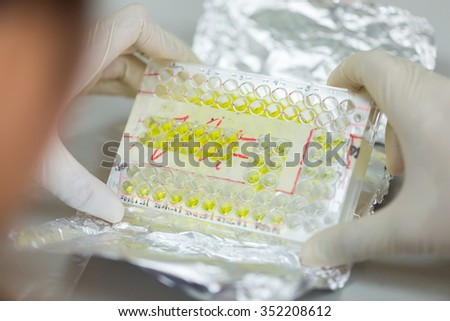 Rear view of Scientist holding a covered 96 well plate with samples,selective focus
