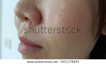 Closeup of a young woman wearing makeup cosmetic on her face, who has oily skin, enlarged pores and blackheads during the working day in the office. Cause of acne problems concept.
