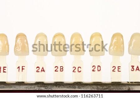 out of date yellow dental color samples