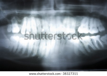 dental x ray on full background