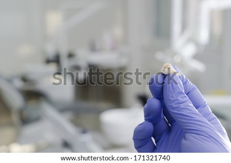 Gloved hand of dentist holding extracted wisdom tooth