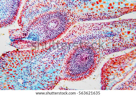 microscopy slides for studying histology- ovary and ovule flower. Micro preparation samples- section (tissue) for microscope examination. Methodology for the research of biology