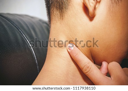 Lymph node inflammation of the throat