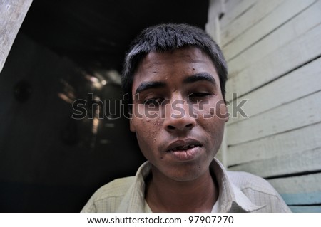 BHOPAL- DECEMBER  4:  Salman Miyan who is blind from his birth allegedly due to toxic chemicals present in her mother\'s body outside his house in Bhopal - India on December 4, 2010.
