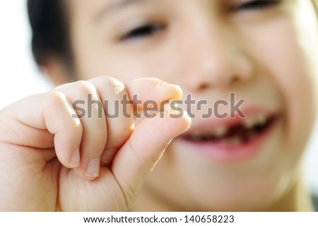 Portrait of cute kid losing his first tooth (Note: Selective focus)