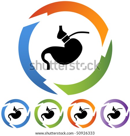 stock vector : Gastric Bypass